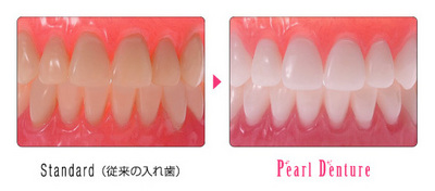 Pearl(BeforeAfter).jpg